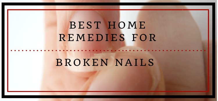 Best Home Remedies For Damaged Nails